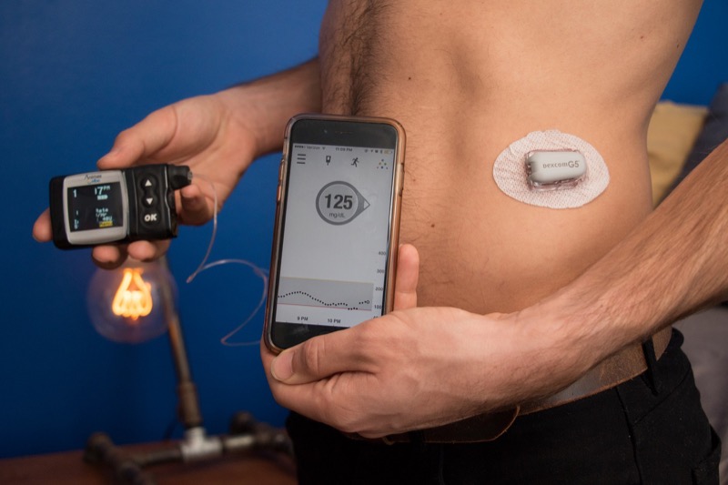 The Visibility and Invisibility of My Body